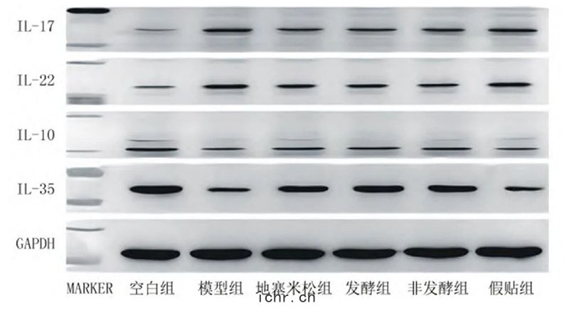 空白(bái)組和支(zhī)氣管(guǎn)哮喘各組(zǔ)大(dà)鼠(shǔ)肺組(zǔ)織(zhī)中(zhōng)IL－17，IL－22，IL－10，IL－35蛋(dàn)白(bái)表達(dá)電(diàn)泳(yǒng)圖
